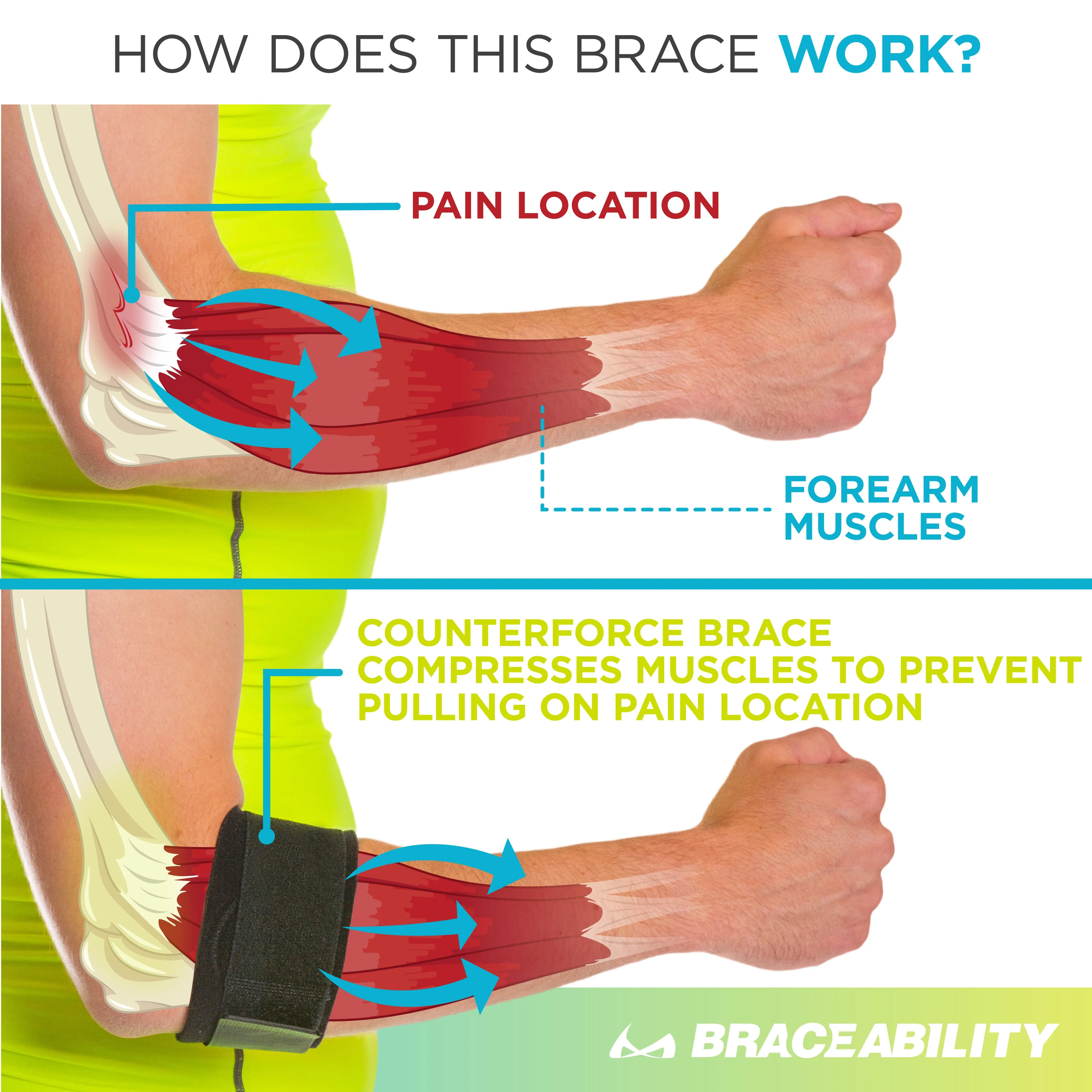 Counterforce Brace | Tendonitis Strap Support Band for Tennis & Golfers Elbow Pain